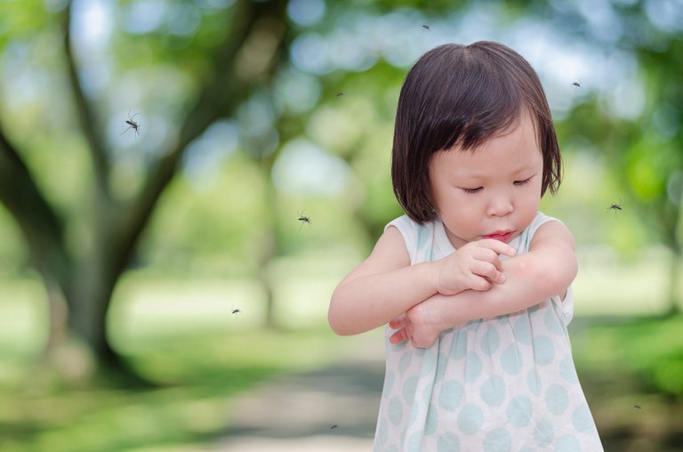 How Do You Treat An Insect Sting While Camping? How Do You Treat An Insect Sting While Camping?