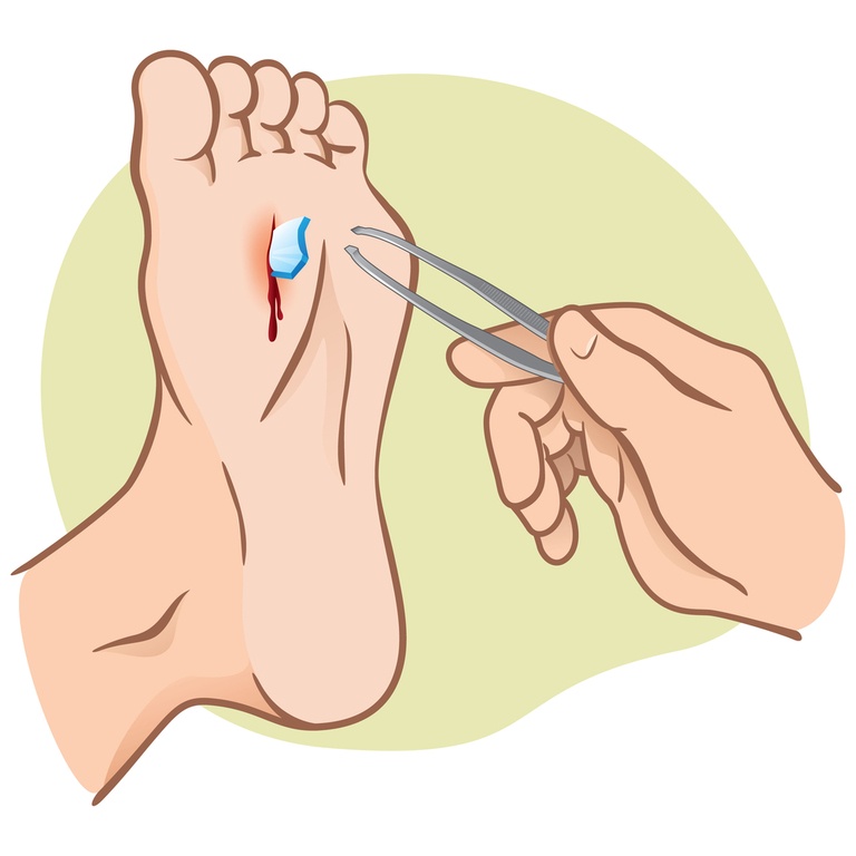 How to Treat Cuts, Scrapes, and Gouges in the Backcountry? How to Treat Cuts, Scrapes, and Gouges in the Backcountry?